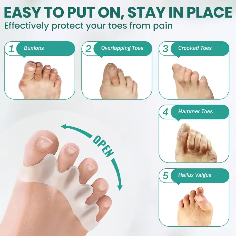 Firmanent Toe Aligners
