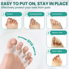 Firmanent Toe Aligners